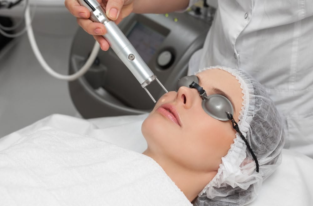 Laser Skin Rejuvenation