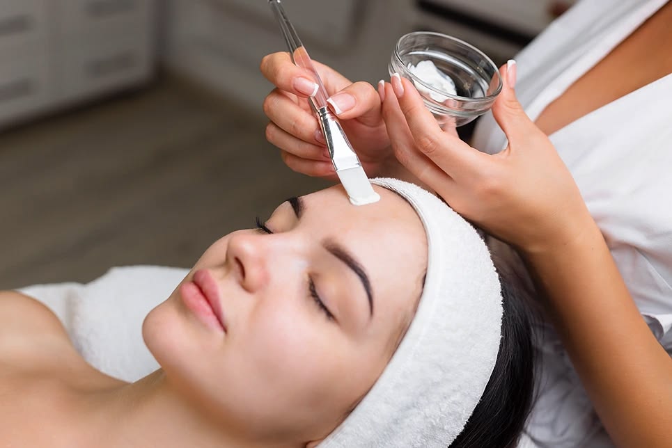 Chemical Peel